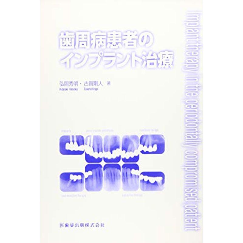 歯周病患者のインプラント治療