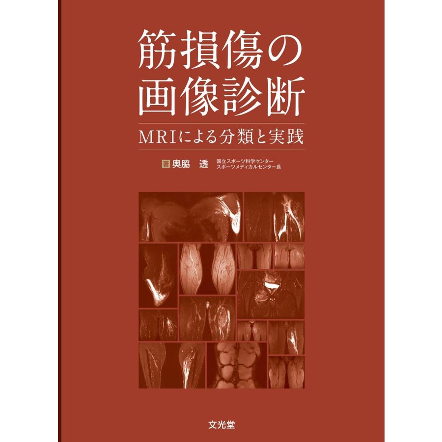 筋損傷の画像診断 MRIによる分類と実践