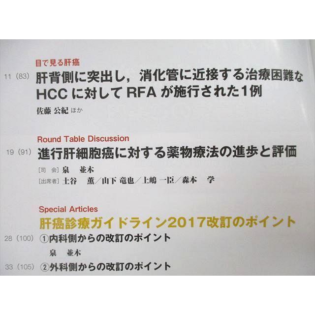 UB25-126 メジカルビュー社 The LIVER CANCER JOURNAL 進行肝細胞癌に対する薬物療法の進歩と評価 2018年9月号 04s3A