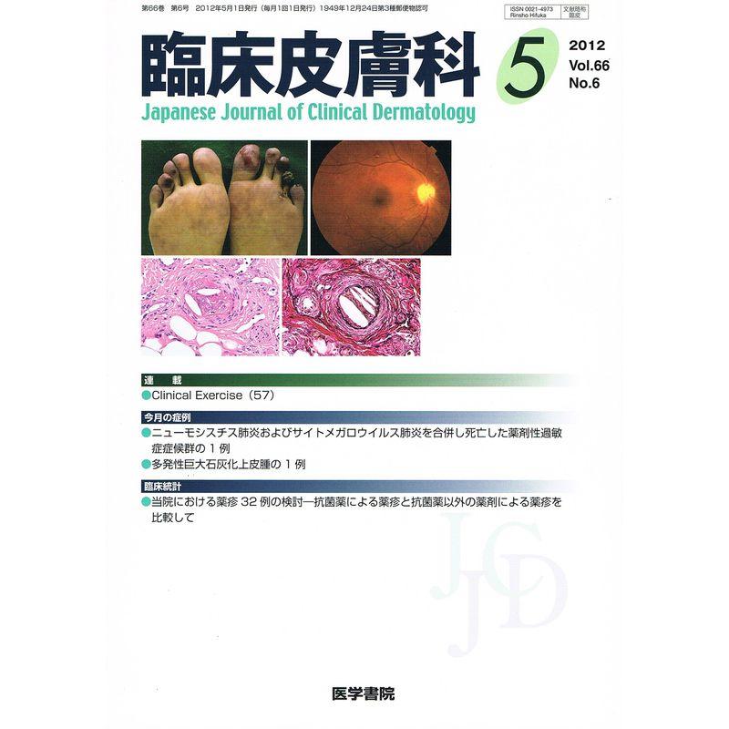 臨床皮膚科 2012年 05月号