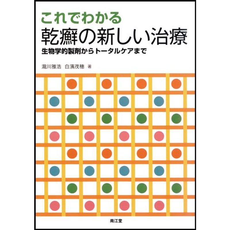 これでわかる乾癬の新しい治療