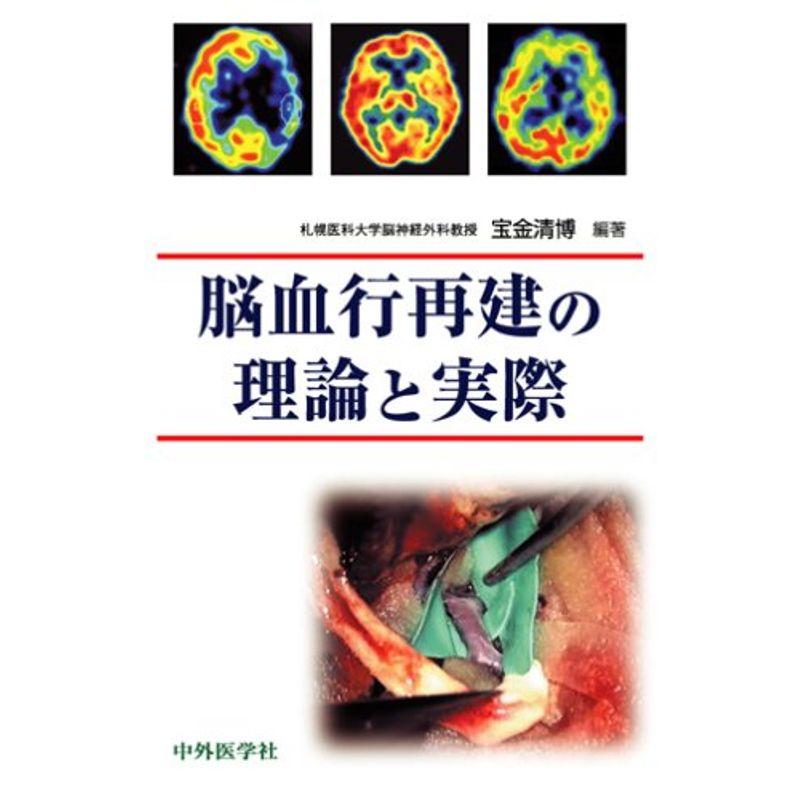 脳血行再建の理論と実際