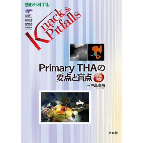 Primary THAの要点と盲点