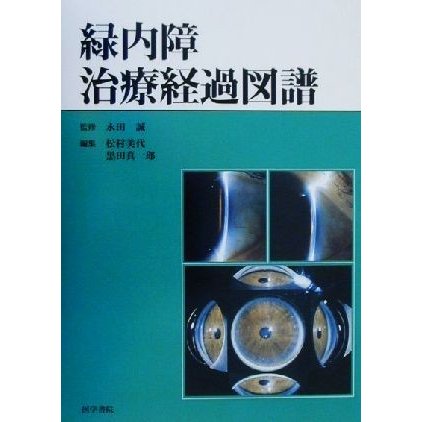 緑内障治療経過図譜／永田誠