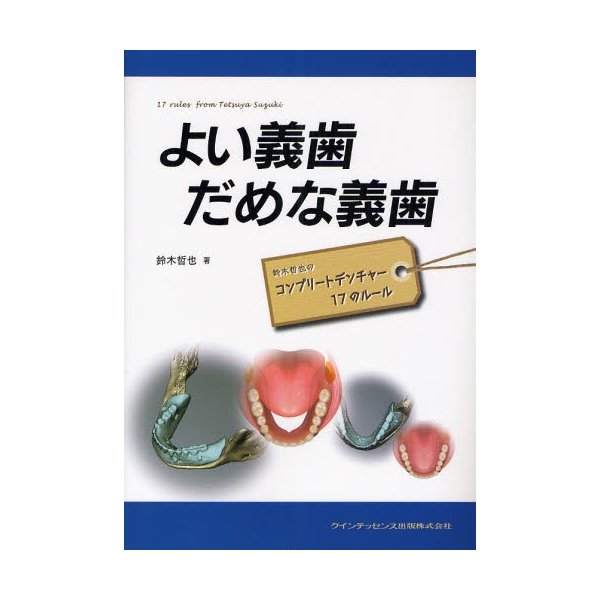 よい義歯だめな義歯 鈴木哲也のコンプリートデンチャー17のルール