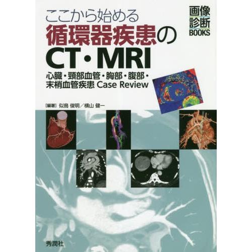 ここから始める循環器疾患のCT・MRI 心臓・頸部血管・胸部・腹部・末梢血管疾患Case Review 似鳥俊明 横山健一