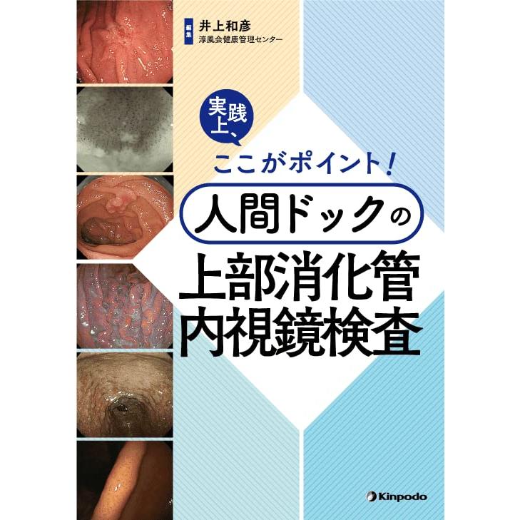 実践上,ここがポイント 人間ドックの上部消化管内視鏡検査