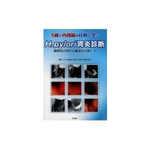 新時代の胃がん検診を目指して ピロリ菌感染を考慮した胃がん検診研究会