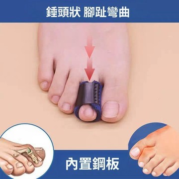 🥇隔日達出💎新款腳趾彎曲矯正器成人兒童爪狀錘狀趾重疊指固定手指矯正帶