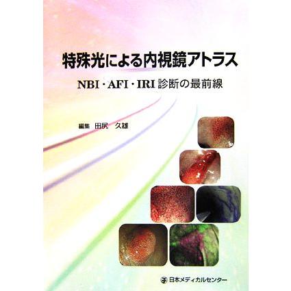 特殊光による内視鏡アトラス ＮＢＩ・ＡＦＩ・ＩＲＩ診断の最前線／田尻久雄