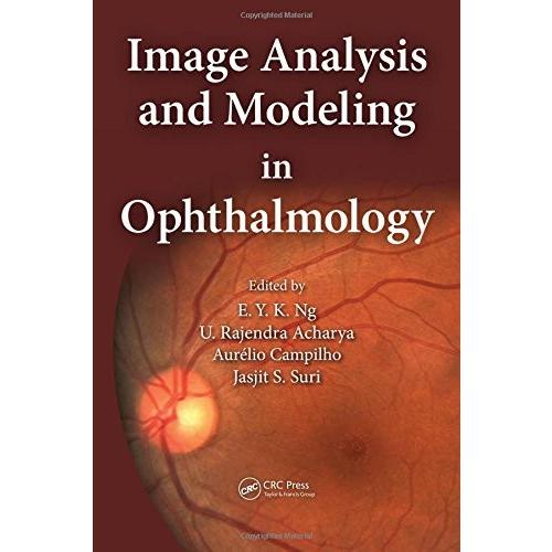 Image Analysis and Modeling in Ophthalmology