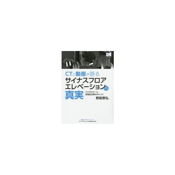 CTと動画が語るサイナスフロアエレベーションの真実 バイオロジーと併発症対策のポイント