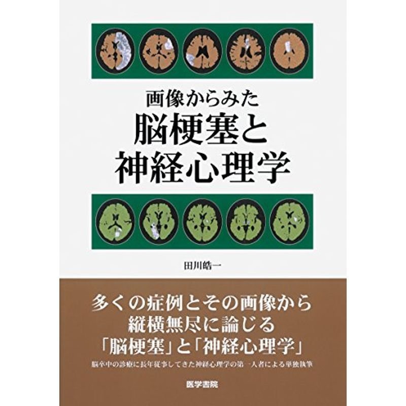 画像からみた 脳梗塞と神経心理学