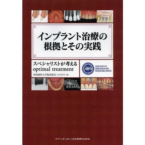 インプラント治療の根拠とその実践 スペシャリストが考えるoptimal treatment