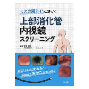 リスク層別化に基づく上部消化管視鏡スクリーニング