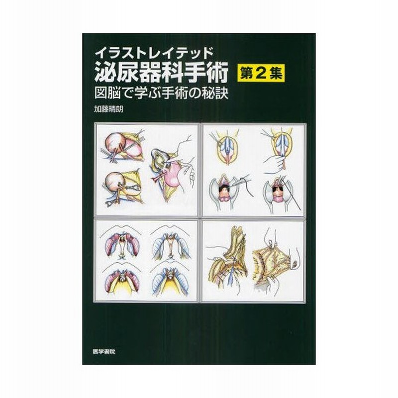 イラストレイテッド泌尿器科手術 第2集 通販 Lineポイント最大get Lineショッピング