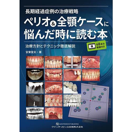 長期経過症例の治療戦略ペリオ 全顎ケースに悩んだ時に読む本 治療方針とテクニック徹底解説