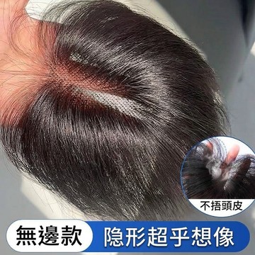 TOP🥇假髮女 頭頂髮片 7*11內網 蝶形網底 八字瀏海 髮片遮白髮 頭頂補髮片 無痕自然 隱形髮片 假髮女 瀏海髮片