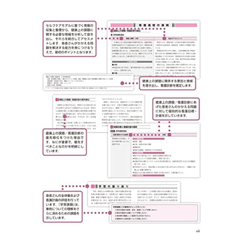 みてわかるできる 事例で学ぶ看護過程 精神看護学 Web動画付