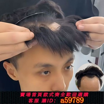 【台灣公司 可打統編】發際線假發貼男士頭頂前額自然隱形發片全真發精修無痕劉海假發片