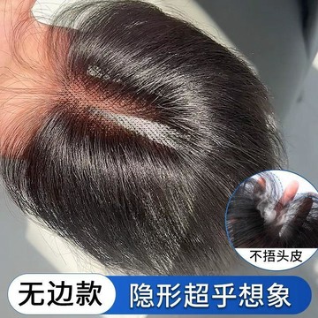 TOP🥇假髮女 頭頂髮片 7*11內網 蝶形網底 八字瀏海 髮片遮白髮 頭頂補髮片 無痕自然 隱形髮片 假髮女 瀏海髮片
