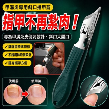 🔥現貨速發🔥甲溝炎專用斜口指甲剪套裝 斜口指甲剪 指甲剪套組 甲溝專用指甲鉗 深層修剪指甲鉗 防夾肉指甲鉗設