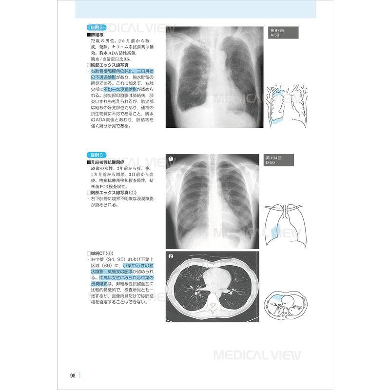 医学生のための画像診断マニュアル 国試問題攻略ガイド