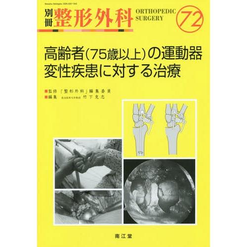 高齢者の運動器変性疾患に対する治療 竹下克志