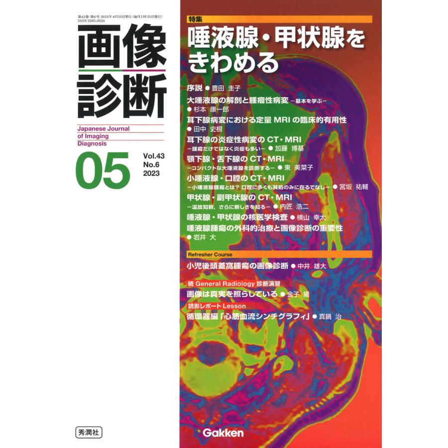 画像診断 Vol.43No.6