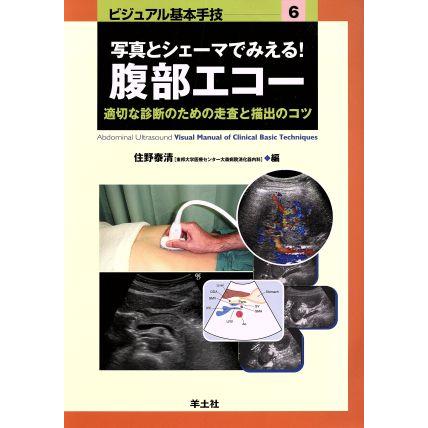 写真とシェーマでみえる！腹部エコー 適切な診断のための走査と描出のコツ ビジュアル基本手技６／住野泰清(著者)