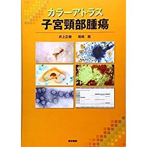 カラーアトラス 子宮頸部腫瘍