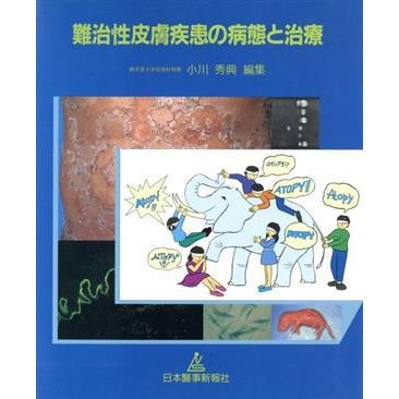 難治性皮膚疾患の病態と治療／小川秀興