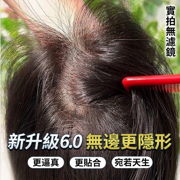 TOP🥇遞針假髮片女 頭頂髮片 髮片遮白髮 遞針頭皮 7*11內網 瀏海髮片 無痕補髮片 法式瀏海 中分瀏海 假髮女