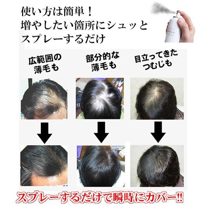 超耐水増毛スプレー「QZプロフェッショナル120ml」薄毛隠し 円形脱毛症 増毛ふりかけやかつら（増毛シート）とは異なる増毛方法 ボリュームアップ  ヘアスプレー | LINEブランドカタログ