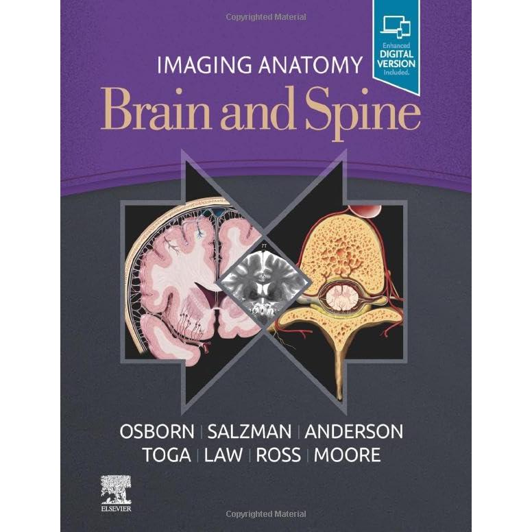 Imaging Anatomy Brain and Spine