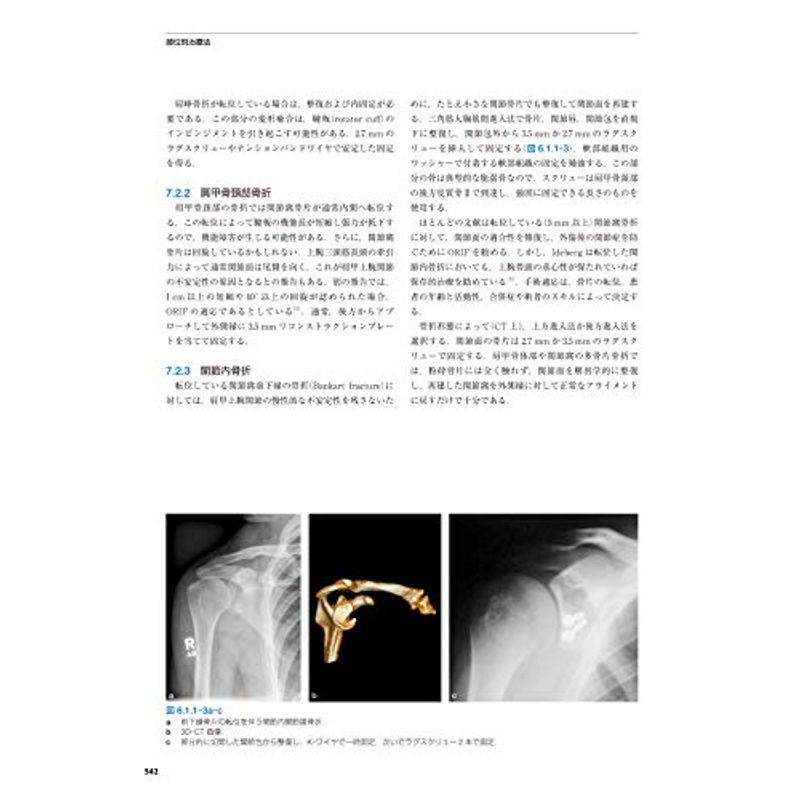 AO法骨折治療英語版Web付録付 第3版