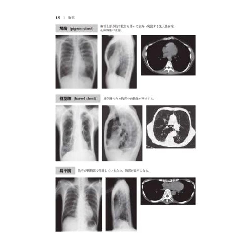 胸部X線・CT画像420症例