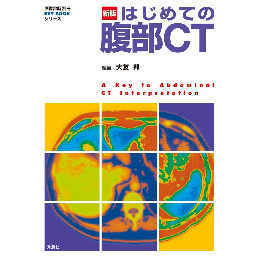 新版 はじめての腹部CT 電子書籍版   大友邦