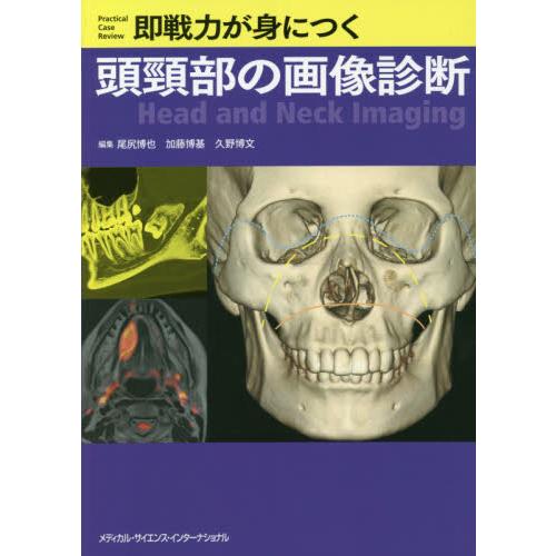 即戦力が身につく頭頸部の画像診断