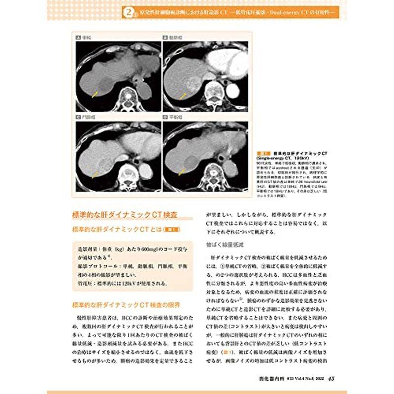 消化器内科 第33号(Vol.4 No.8,2022)特集:肝疾患における画像診断の進歩 ?腹部超音波,CT,MRI?