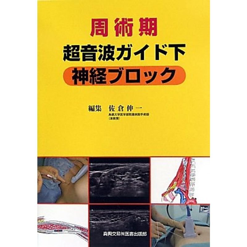 周術期超音波ガイド下神経ブロック