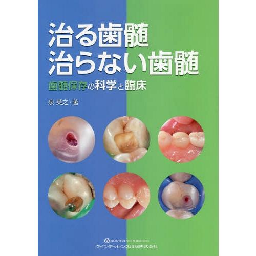 治る歯髄治らない歯髄 歯髄保存の科学と臨床