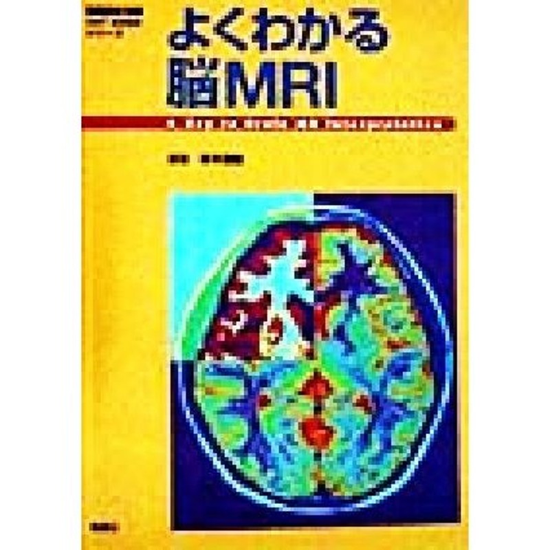 よくわかる脳ＭＲＩ　画像診断別冊ＫＥＹＢＯＯＫシリーズ／青木茂樹(著者)　LINEショッピング