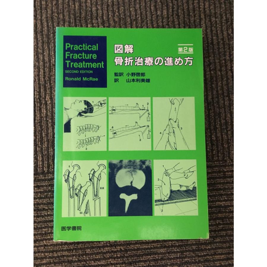 図解骨折治療の進め方   Ronald McRae