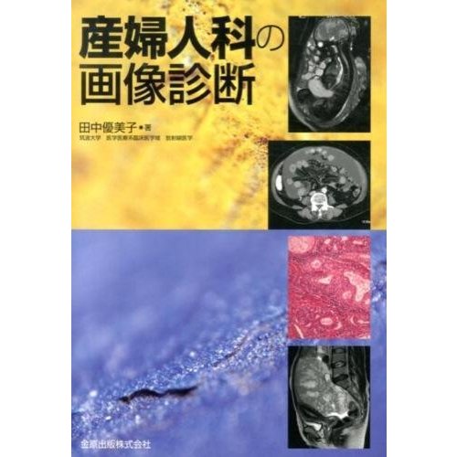 産婦人科の画像診断