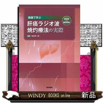 動画で学ぶ肝癌ラジオ波焼灼療法の実際