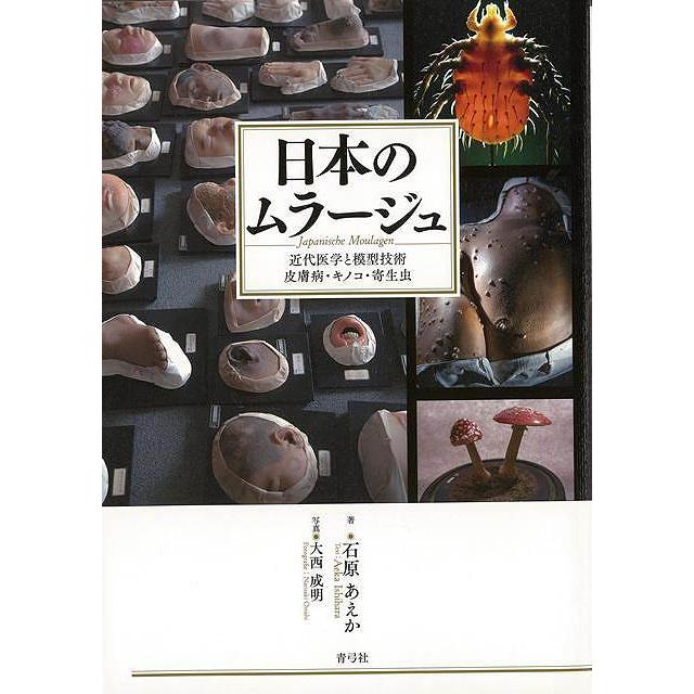 日本のムラージュ 近代医学と模型技術 皮膚病・キノコ・寄生虫