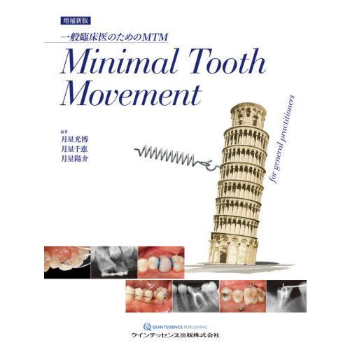 Minimal Tooth Movement 一般臨床医のためのMTM