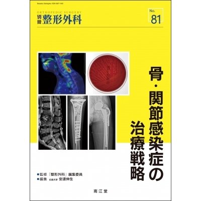 骨・関節感染症の治療戦略