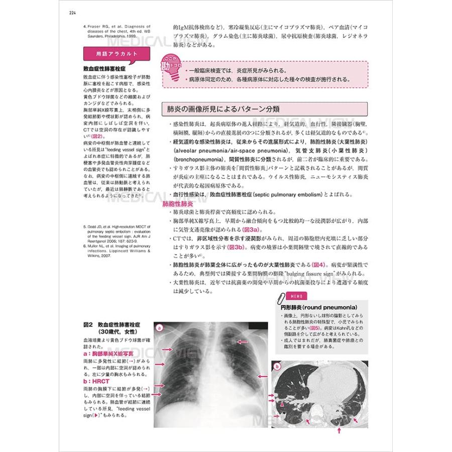 胸部 画像診断の勘ドコロNEO